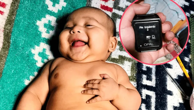 A wearable movement sensor placed on an infant’s leg.